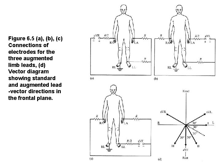 Figure 6. 5 (a), (b), (c) Connections of electrodes for the three augmented limb