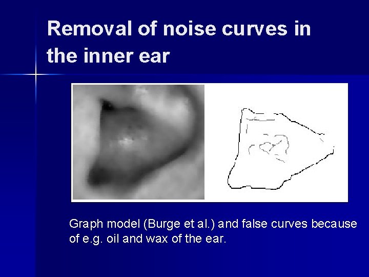 Removal of noise curves in the inner ear Graph model (Burge et al. )