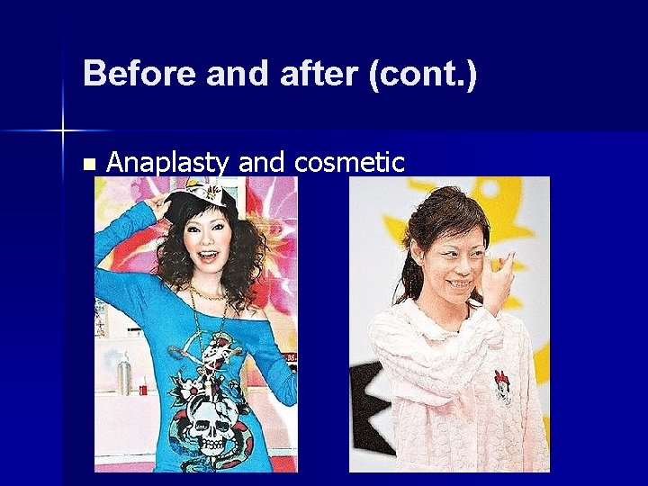 Before and after (cont. ) n Anaplasty and cosmetic 