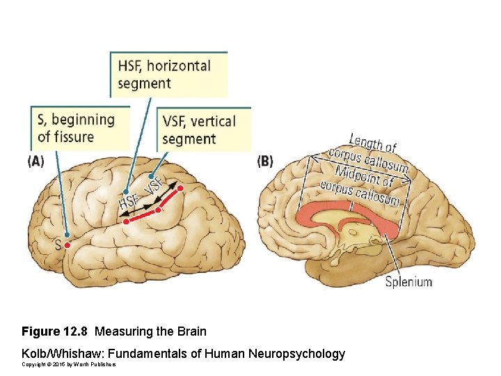 Figure 12. 8 Measuring the Brain Kolb/Whishaw: Fundamentals of Human Neuropsychology Copyright © 2015