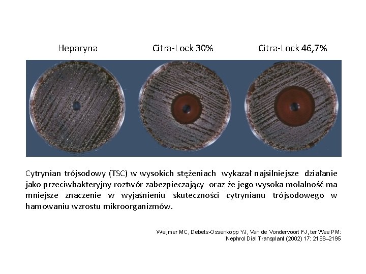Heparyna Citra-Lock 30% Citra-Lock 46, 7% Cytrynian trójsodowy (TSC) w wysokich stężeniach wykazał najsilniejsze