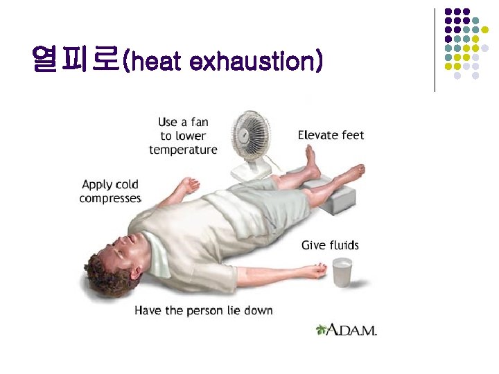 열피로(heat exhaustion) 