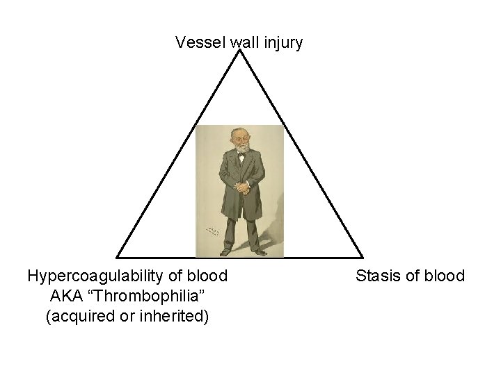 Vessel wall injury Hypercoagulability of blood AKA “Thrombophilia” (acquired or inherited) Stasis of blood