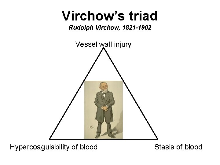 Virchow’s triad Rudolph Virchow, 1821 -1902 Vessel wall injury Hypercoagulability of blood Stasis of