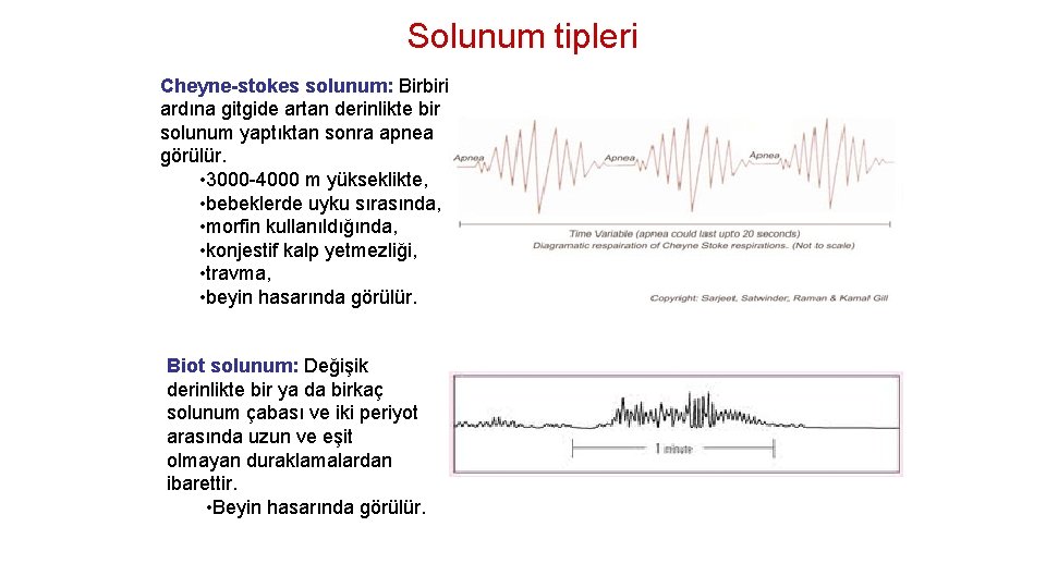 Solunum tipleri Cheyne-stokes solunum: Birbiri ardına gitgide artan derinlikte bir solunum yaptıktan sonra apnea