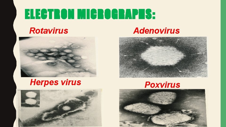 ELECTRON MICROGRAPHS: Rotavirus Herpes virus Adenovirus Poxvirus 