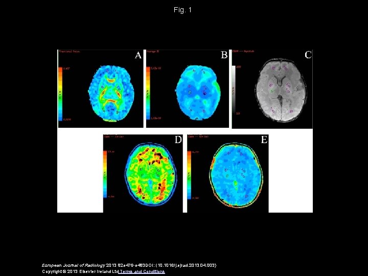 Fig. 1 European Journal of Radiology 2013 82 e 476 -e 483 DOI: (10.