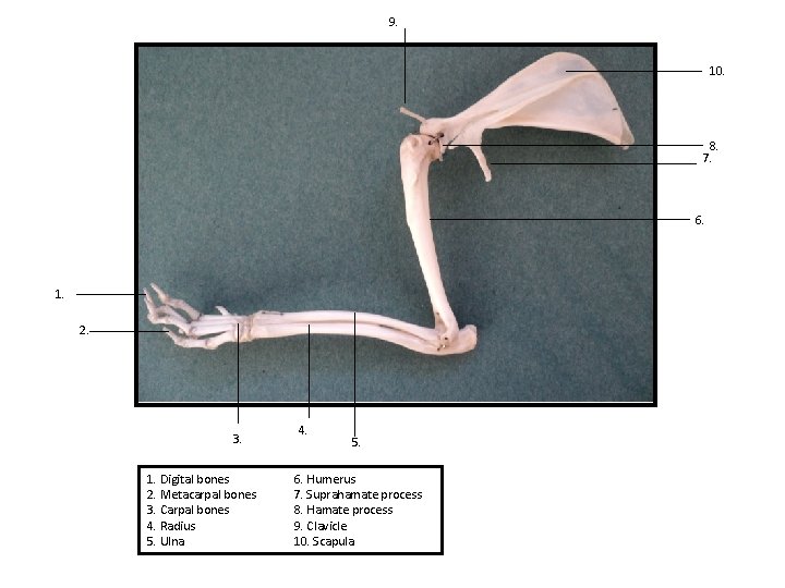 9. 10. 8. 7. 6. 1. 2. 3. 1. Digital bones 2. Metacarpal bones