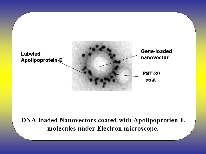 Labeled Apolipoprotein-E Gene-loaded nanovector PST-80 coat DNA-loaded Nanovectors coated with Apolipoprotien-E molecules under Electron