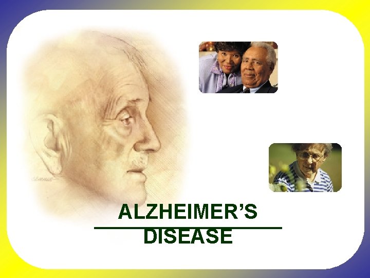 ALZHEIMER’S DISEASE 