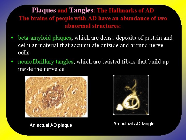 Plaques and Tangles: The Hallmarks of AD The brains of people with AD have
