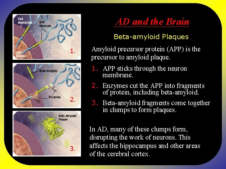 AD and the Brain Beta-amyloid Plaques 1. Amyloid precursor protein (APP) is the precursor