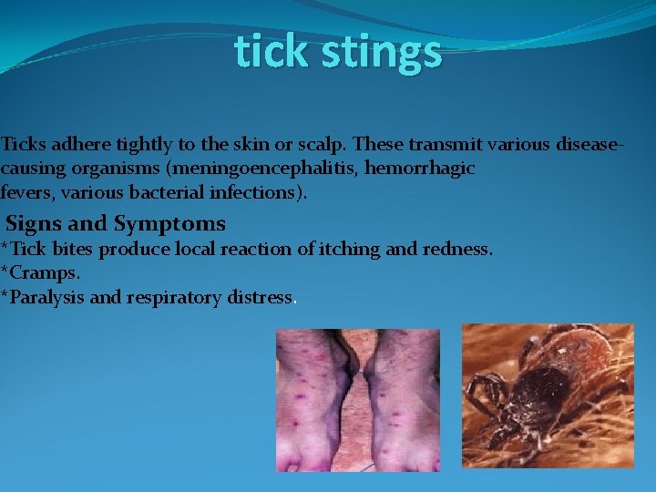 tick stings Ticks adhere tightly to the skin or scalp. These transmit various diseasecausing