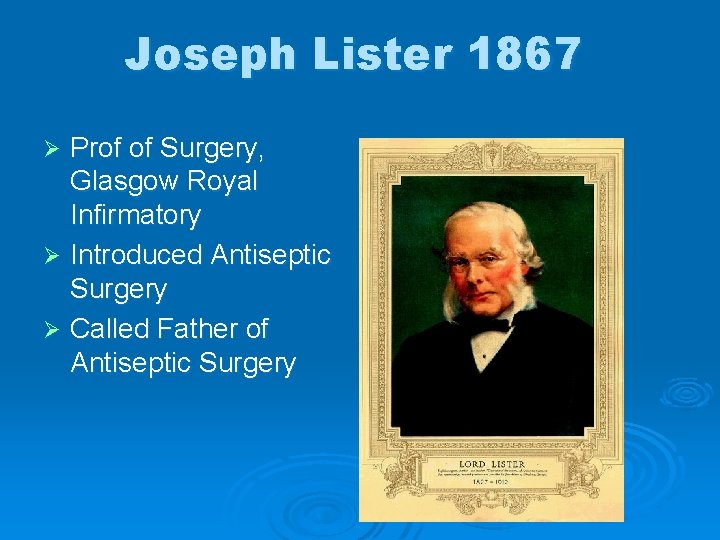 Joseph Lister 1867 Prof of Surgery, Glasgow Royal Infirmatory Ø Introduced Antiseptic Surgery Ø