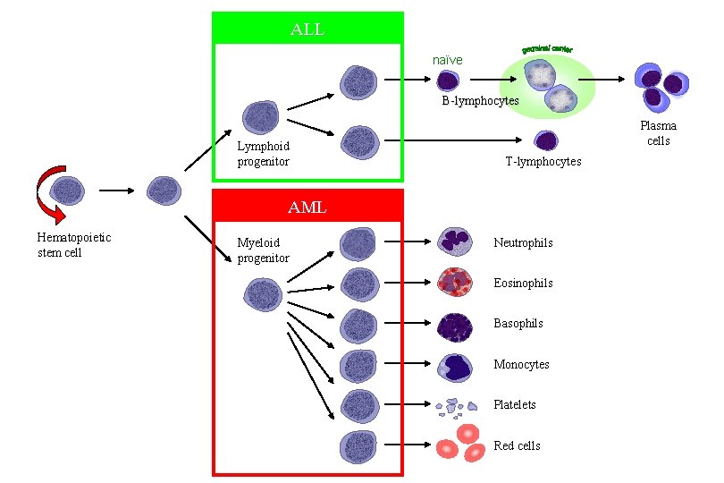 ALL naïve B-lymphocytes Lymphoid progenitor Plasma cells T-lymphocytes AML Hematopoietic stem cell Myeloid progenitor