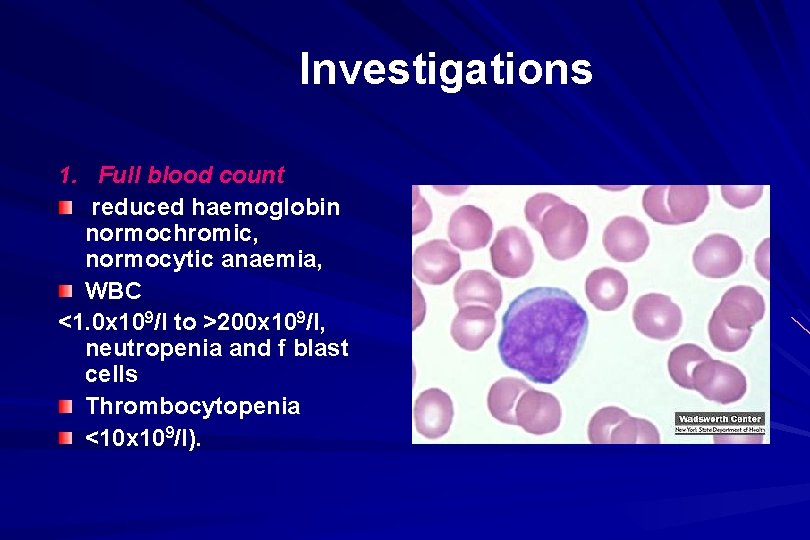 Investigations 1. Full blood count reduced haemoglobin normochromic, normocytic anaemia, WBC <1. 0 x