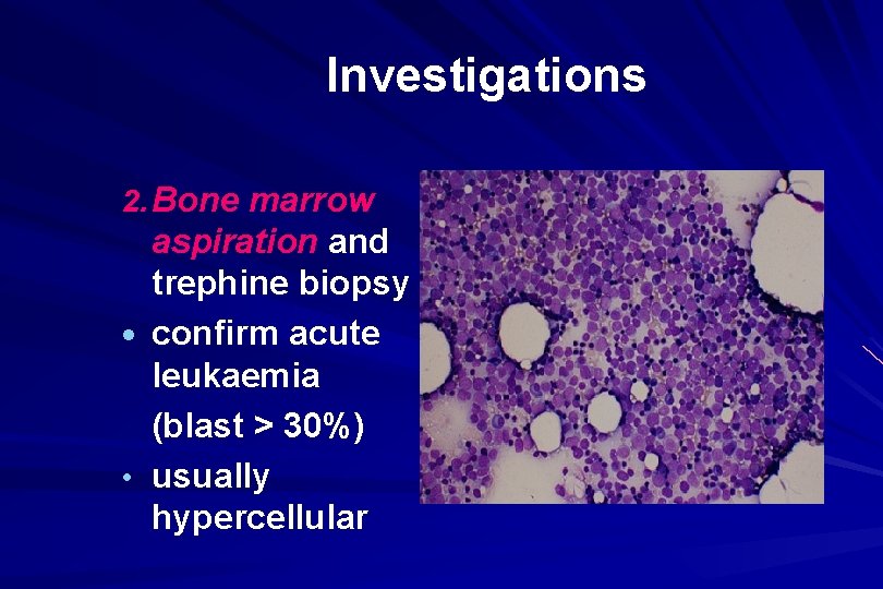 Investigations 2. Bone marrow aspiration and trephine biopsy · confirm acute leukaemia (blast >