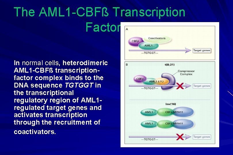 The AML 1 -CBFß Transcription Factor In normal cells, heterodimeric AML 1 -CBFß transcriptionfactor