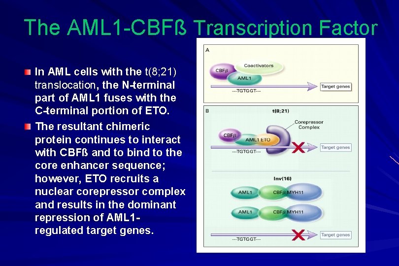 The AML 1 -CBFß Transcription Factor In AML cells with the t(8; 21) translocation,