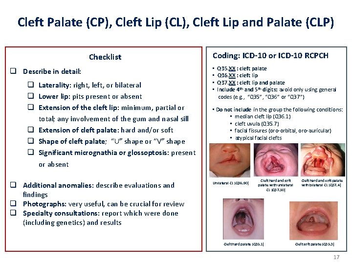 Cleft Palate (CP), Cleft Lip (CL), Cleft Lip and Palate (CLP) Checklist q Describe