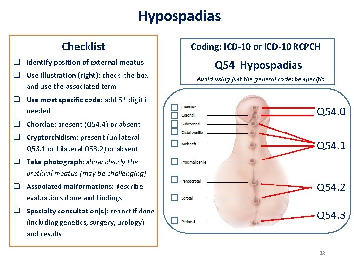 Hypospadias Checklist q Identify position of external meatus q Use illustration (right): check the