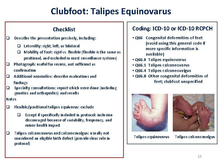 Clubfoot: Talipes Equinovarus Checklist q Describe the presentation precisely, including: q Laterality: right, left,