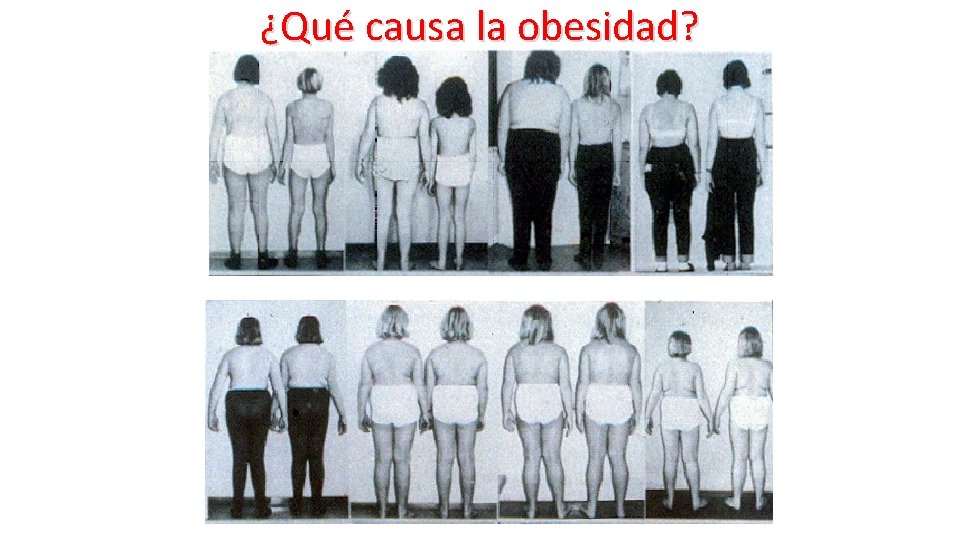 ¿Qué causa la obesidad? 