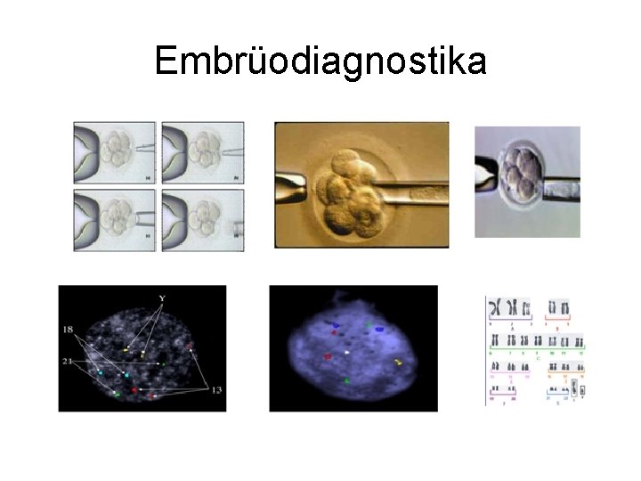 Embrüodiagnostika 