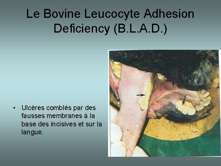 Le Bovine Leucocyte Adhesion Deficiency (B. L. A. D. ) • Ulcères comblés par