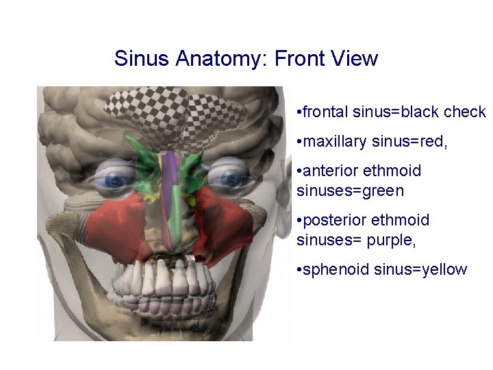 Sinus Anatomy: Front View • frontal sinus=black check • maxillary sinus=red, • anterior ethmoid