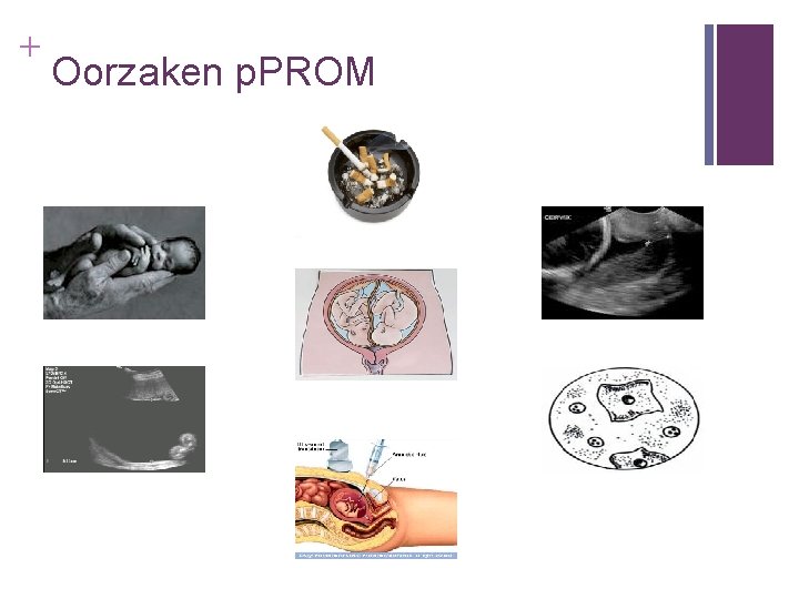 + Oorzaken p. PROM 