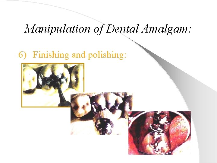 Manipulation of Dental Amalgam: 6) Finishing and polishing: 