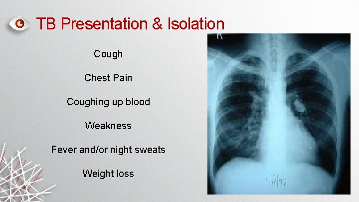 TB Presentation & Isolation Cough Chest Pain Coughing up blood Weakness Fever and/or night TB Presentation & Isolation Cough Chest Pain Coughing up blood Weakness Fever and/or night