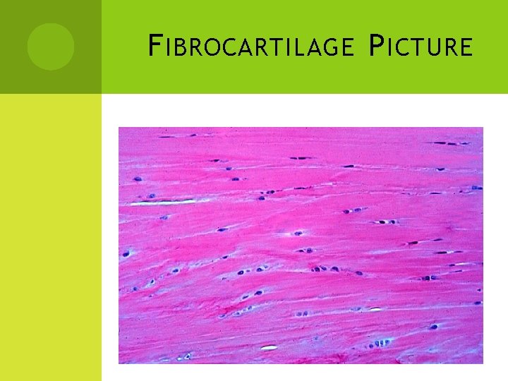 F IBROCARTILAGE P ICTURE 