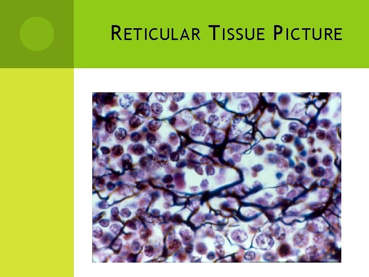 R ETICULAR T ISSUE P ICTURE 