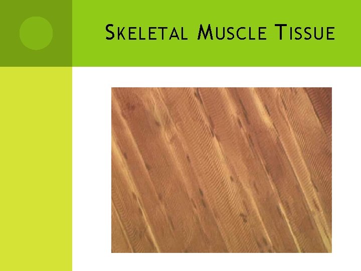 S KELETAL M USCLE T ISSUE 