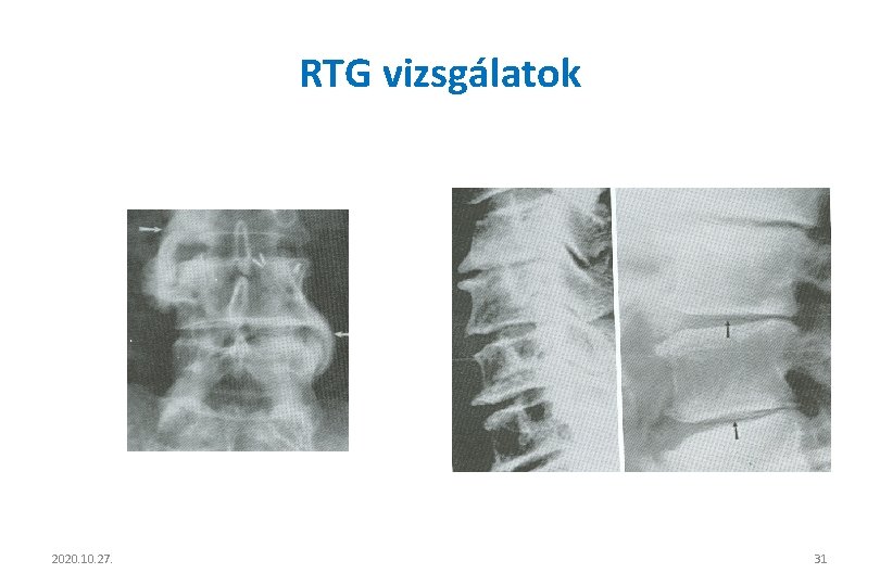 RTG vizsgálatok 2020. 10. 27. 31 