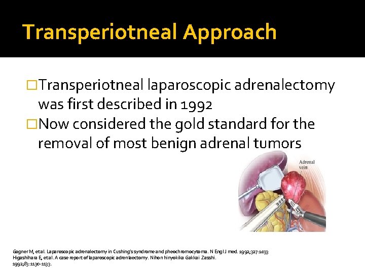 Transperiotneal Approach �Transperiotneal laparoscopic adrenalectomy was first described in 1992 �Now considered the gold
