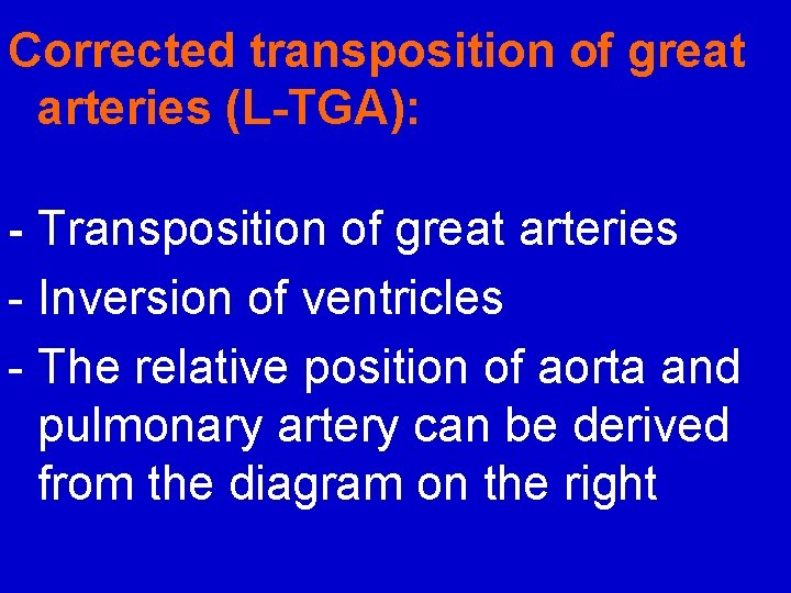 Corrected transposition of great arteries (L-TGA): - Transposition of great arteries - Inversion of