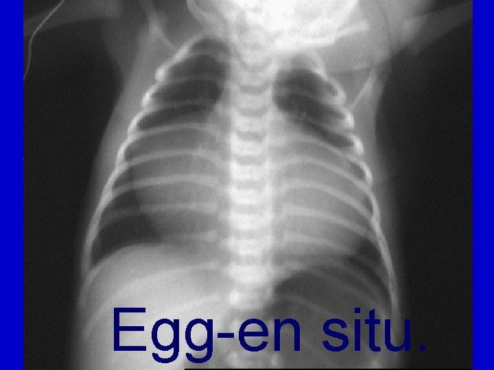 Egg-en situ. 