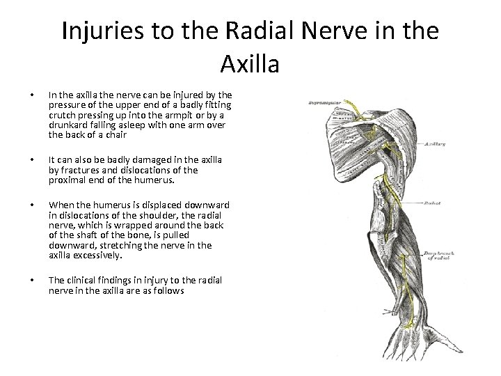 Injuries to the Radial Nerve in the Axilla • In the axilla the nerve