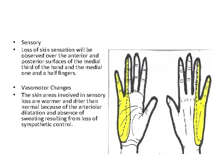  • Sensory • Loss of skin sensation will be observed over the anterior