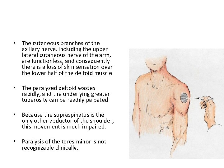  • The cutaneous branches of the axillary nerve, including the upper lateral cutaneous