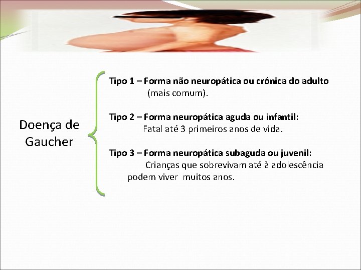 Tipo 1 – Forma não neuropática ou crónica do adulto (mais comum). Doença de