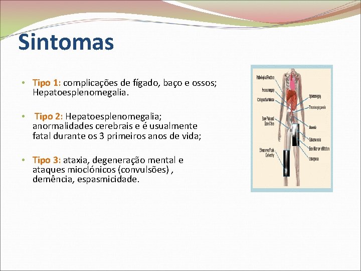 Sintomas • Tipo 1: complicações de fígado, baço e ossos; Hepatoesplenomegalia. • Tipo 2: