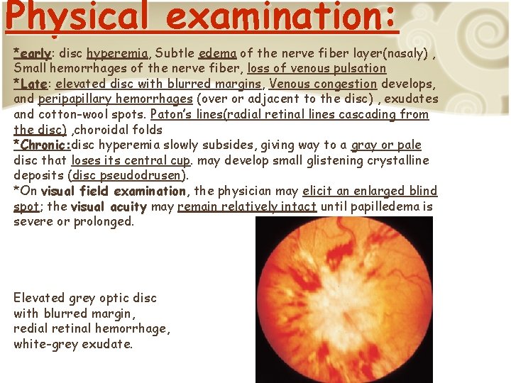 Physical examination: *early: disc hyperemia, Subtle edema of the nerve fiber layer(nasaly) , Small
