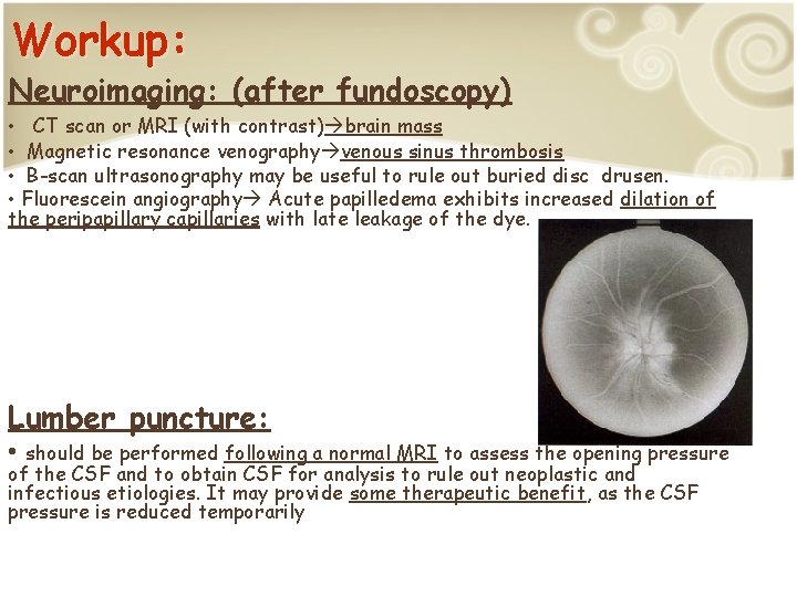 Workup: Neuroimaging: (after fundoscopy) CT scan or MRI (with contrast) brain mass • Magnetic