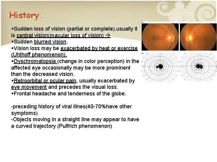 History: §Sudden loss of vision (partial or complete). usually it is central vision(macular loss