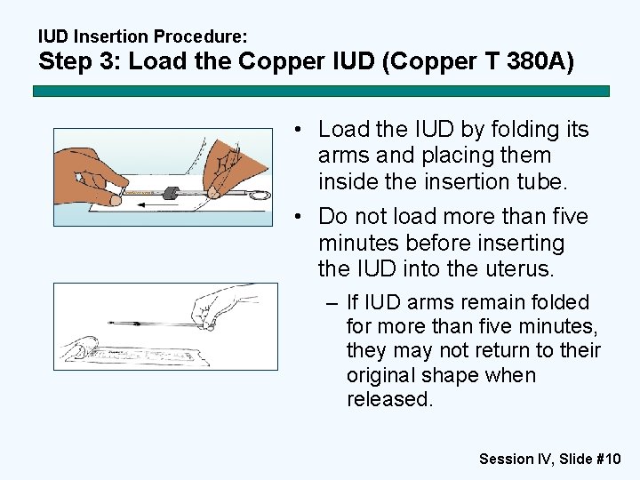 IUD Insertion Procedure: Step 3: Load the Copper IUD (Copper T 380 A) •