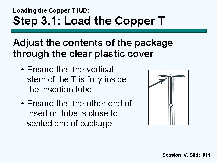 Loading the Copper T IUD: Step 3. 1: Load the Copper T Adjust the